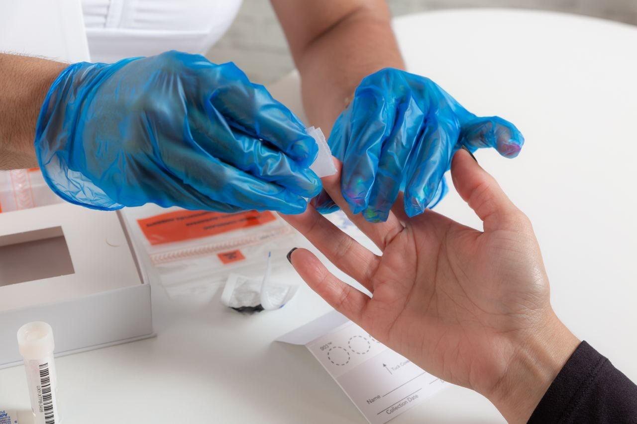 Toma de muestra de sangre capilar mediante punción digital